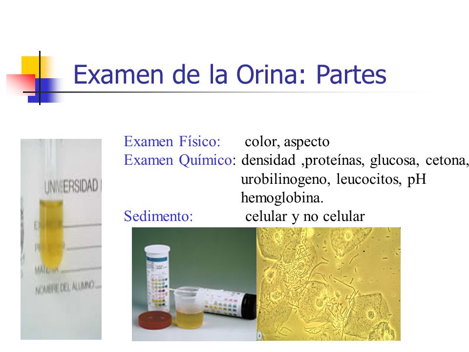 analisis de pis proteinas indicios